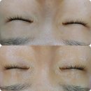 유스라벨라샵 | 대구피부관리 달서구피부관리샵 <유스라벨라샵> 대구신부관리 추천해요:)