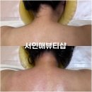 황금뷰티 | 수성구에스테틱 대구 황금드레스라인케어 후기 서인애뷰티샵