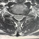 우림빌딩 | [공지] 송파 목디스크 MRI 후기🏥 ┃우림영상의학과의원 MRI 3.0T 촬영결과🎞