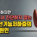 갑상선기능저하증의 유일한 치료 방법은 이 원인을 파악하는 것 이미지