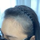 포레라인