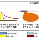 한림대춘천성심병원, 전이개낭종 최소절개접근법 개발 이미지