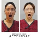 한달음한의원 | 부산안면비대칭 스트레스 서면 한의원 연예인 교정 후기