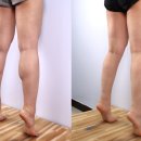 DOC POWER | [2026 트렌드] 각선미의 완성은 종아리알 관리! BMI와 초음파로 찾는 황금 비율 가이드 - 세이지의원