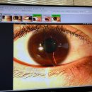 서대구안과의원 | 부천 신중동 안과 추천 | 새로운세상안과의원 알러지 진료 가격 및 후기