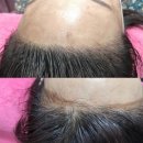 희야헤어 - 문경시 | 대구 죽전역 헤어라인 케어 희야뷰티 방문 후기