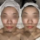 채움올림에스테틱 | 천안 윤곽관리 잘하는 곳 채움올림 솔직 후기