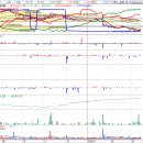 주식회사 제이시스메디칼 이미지