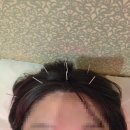 중원한의원 | 노원 다이어트한의원 상담 후기｜노원 한약 다이어트 3일만에 -2kg 실제 후기