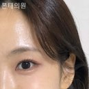 본태의원 네이버블로그
