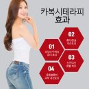 엔비 테라피 이미지