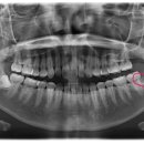 웃는하루치과의원 이미지