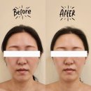 금령로106번길 | [처인구피부관리] 용인윤곽관리 잘하는 에스테틱원아워 주차정보 및 3V 윤곽테라피 솔직후기