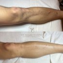 마이슈가왁싱 이미지