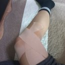정강한의원 | 장경인대 통증 (원인, 치료, 정형외과&amp;한의원 진료 후기)