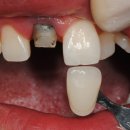 아이디얼치과기공소 이미지