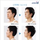 뼈연구소 이미지