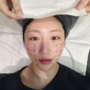 마디탄탄병원 | 부산 피부과 써마지FLX 300샷 후기 화명동 수면써마지 추천