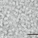 해상 가두리 양식 은연어 근육 기생 Microsporidium에 의한 요철병(beko disease) 이미지