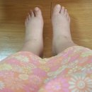 청오빌딩 | [임신 37주 2일] 방배동 현산부인과 제왕절개 출산 후기