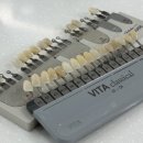 페이스치과기공소 | 강남전체임플란트 강남엔터치과 부담 없이 방문하는 치과