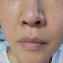 기분좋은365의원 | 신사역 셀365웰의원 줄기세포주사+스킨스티컬즈관리+LDM 후기