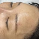 미엘헤어 | 해운대브라질리언왁싱 가능 센텀왁싱샵 추천 미엘왁싱 하프페이스왁싱 받고 깔끔해진 후기