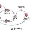 발진티푸스[Epidemic typhus] 감염성 질환 이미지