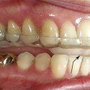 스페셜기공소 이미지