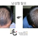 불로장생모