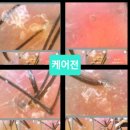 감탄헤드스파 두피클리닉