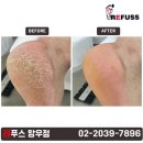 레푸스 망우점