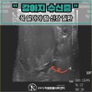 전북대학교 수의방역대학원 | 신장 수치 이상? 수신증 수술로 다시 살아난 17살 말티즈