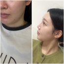 키리스피부관리대구범어점 | 대구피부관리 윤곽관리 후기/핫탄스파 범어점