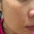 마미약국 | 마미케어 손담비기미앰플 오쏘타민 비타민C앰플 사용후기