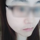 유앤미스킨케어 네이버블로그