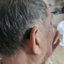 열린보청기 이미지