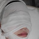 더 스킨 피부관리