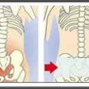 바른 자세를 위한 골반척추교정 스트레칭 이미지