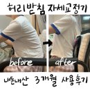 평등 | 허리받침 자세교정 기구 시원허리 편평등교정기 3개월 사용 찐 후기