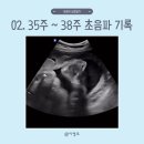 11545-02-38-20 | 아랑이 성장일기 | 02. 35주 ~ 38주 태아 초음파 기록(호산병원, 막달검사, 태동검사, 내진 후기)