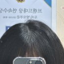 동성개발 | 대구 탈모 관리, 웰킨두피탈모센터 대구동성점 두피 관리 후기