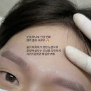 더모먼트 이미지