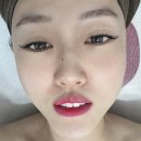 에이치앤에이치 | 광주 피부관리 북구 각화동 에이치앤에이치 쏙케어 후기