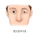 솔재활의학과의원 네이버블로그
