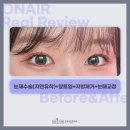 온에어성형외과의원 이미지