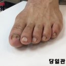 레푸스 서면점