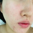 예쁜여우피부관리 이미지
