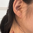 맑은유영상의학과의원 | 병원 일기 | 역류성식도염? 인파선염?갑상선?종양?정체가 뭐니