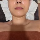 천안백석동웨딩관리 천안백석동 윤곽관리 잘하는 곳 예지미스킨앤바디 솔직후기
